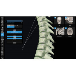 3D Organon XR | Premium