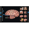 3D Organon for your desktop | Standard